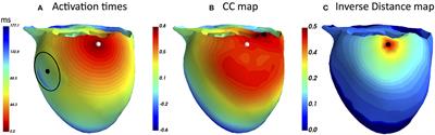 ECG Adapted Fastest Route Algorithm to Localize the Ectopic Excitation Origin in CRT Patients